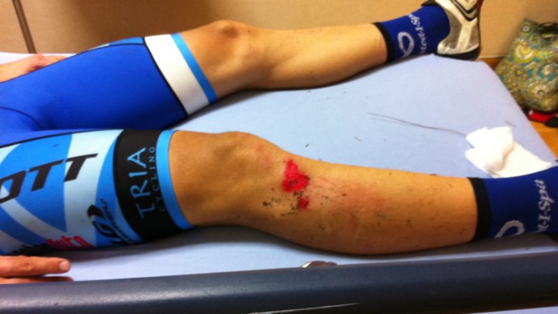 How to Treat Road Rash and Abrasions?